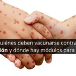 ¿Quiénes deben vacunarse contra el sarampión y dónde hacerlo en México?